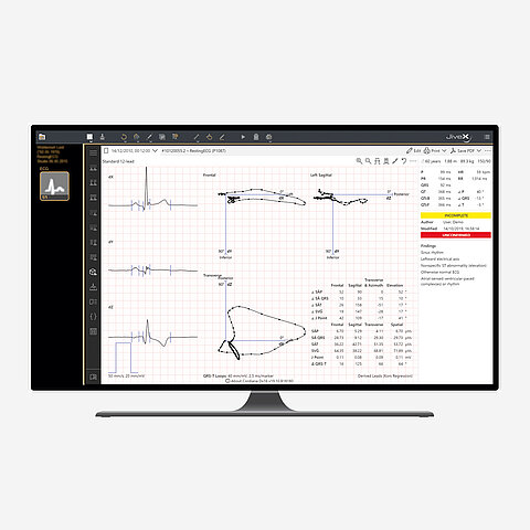 EKG-Befundung: JiveX ECG Advanced mit neuen Funktionen EKG-Befundung: JiveX ECG Advanced mit neuen Funktionen