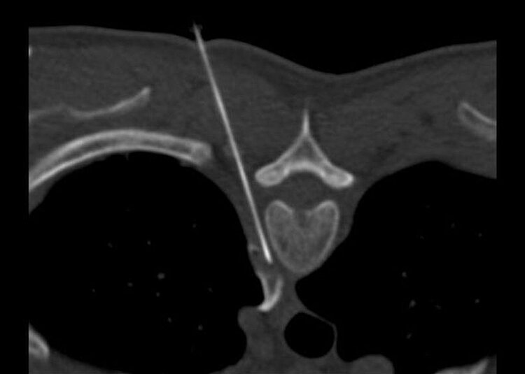 Diagnostischen Radiologie mit JiveX Enterprise PACS 