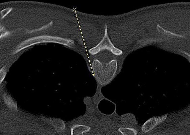 Diagnostischen Radiologie mit JiveX Enterprise PACS 